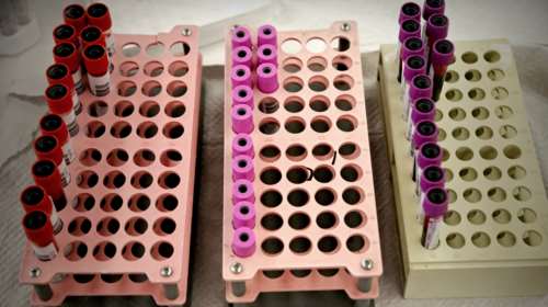 Κορονοιός: Οξεία μείωση των αποθεμάτων αίματος - Ξεκινούν υπαίθριες αιμοδοσίες