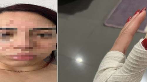 Υπό κράτηση δύο Ελληνοκύπριοι για τον ξυλοδαρμό 25χρονης Τουρκοκύπριας - Το θέμα έφτασε σε Χριστοδουλίδη και Τατάρ