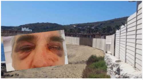 Μύκονος: Παρέμβαση Ντογιάκου για το όργιο οικοδοµικών αυθαιρεσιών - Ζητά κατ΄ απόλυτη προτεραιότητα εισαγγελική έρευνα