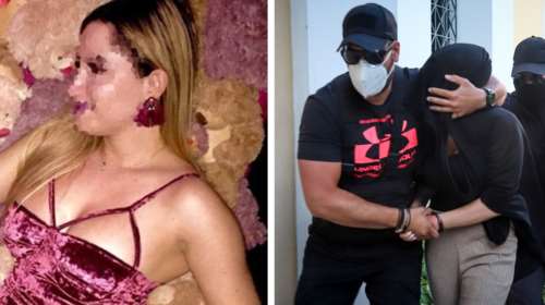 Επίθεση με βιτριόλι: Η 35χρονη είχε στο κινητό της φωτογραφίες από το σπίτι της Ιωάννας