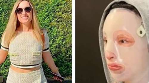 Επίθεση με βιτριόλι: Ένας χρόνος από το πρωινό που άλλαξε τη ζωή της Ιωάννας για πάντα – Το μήνυμά της