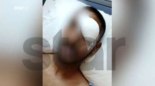 Ραφήνα: Νεαρός καταγγέλλει ότι έχασε το μάτι του  - Σήκωσε την καραμπίνα και άρχισε να πυροβολεί αδιακρίτως, μέσα στο σκοτάδι