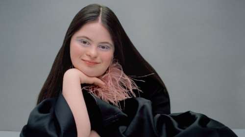 Έλι Γκολντστάιν: Γράφει ιστορία το πρώτο μοντέλο με σύνδρομο Down