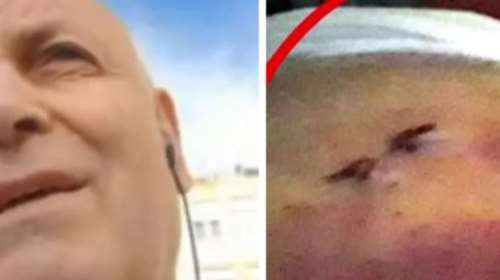 &quot;Έχασα 2,5 λίτρα αίμα&quot;, λέει σοκαρισμένος ο μάγειρας που μαχαιρώθηκε  από πελάτη που δεν του άρεσε το... κοντοσούβλι