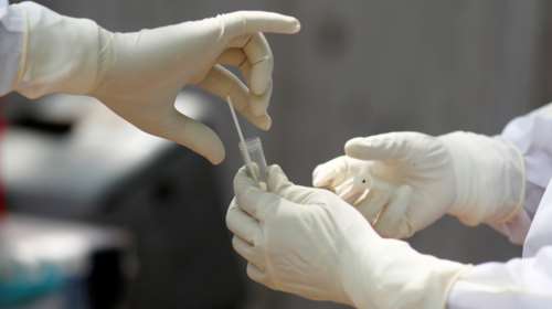 Η επιθεώρηση The Lancet παίρνει αποστάσεις από την έρευνα για τη χρήση υδροξυχλωροκίνης