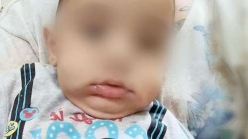 Αμαλιάδα: Στο μικροσκόπιο τα σημάδια στο πρόσωπο του Παναγιωτάκη - Τι αναφέρει το πόρισμα Γκότση