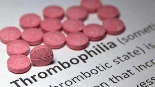 Τι είναι η θρομβοφιλία και πότε πρέπει να ξέρουμε εάν έχουμε προδιάθεση