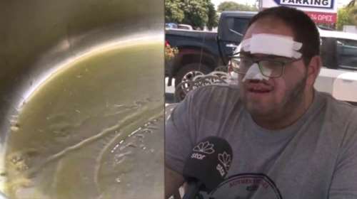 Κρήτη: "Τελείωνε, βιαζόμαστε"- Η "έκρηξη" στο λάδι που προκάλεσε τα εγκαύματα στον 22χρονο μάγειρα