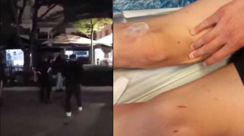 Καλαμάτα: Ξυλοδαρμός - σοκ 16χρονων από συμμορία ανηλίκων - &quot;Εκδίκηση για ένα κορίτσι&quot;