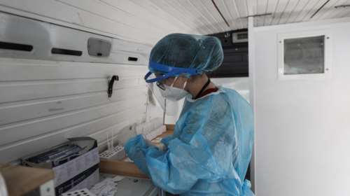 Κορονοϊός: Δεν κινδυνεύουν μόνο οι πνεύμονες αλλά και τα μάτια