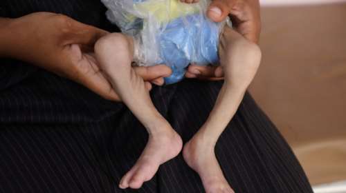 Για πρώτη φορά δύο ισραηλινές ΜΚΟ εκτιμούν ότι το Ισραήλ διαπράττει γενοκτονία στη Γάζα