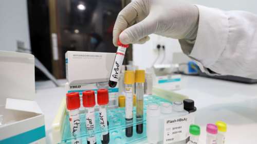 Εκδίδεται η ΚΥΑ για το πλαφόν στα τεστ κορονοϊού και στις ιατρικές υπηρεσίες