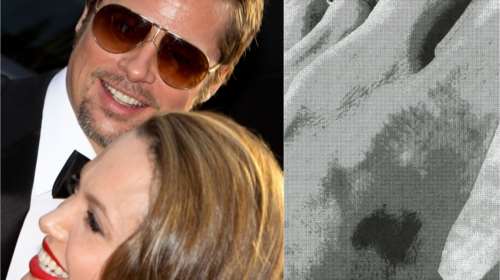 Αντζελίνα Τζολί: Οι μώλωπες μετά τον άγριο καβγά με τον Μπραντ Πιτ σε ιδιωτικό τζετ - &quot;Είσαι καλά μαμά;&quot;