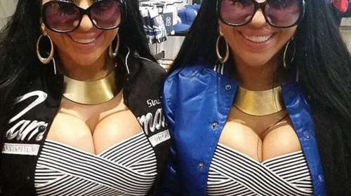 Δίδυμες μοιράζονται τα πάντα έως και το αγόρι τους