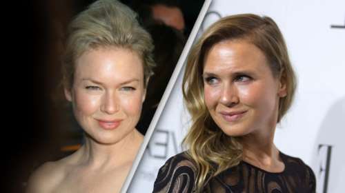 Οι φήμες οργιάζουν: Η φωτογράφηση της Ρενέ Ζελβέγκερ με νέο πρόσωπο [φωτο]