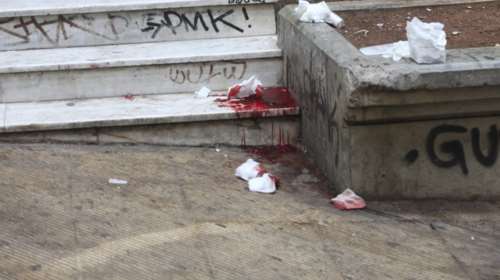 Υπέκυψε στα τραύματά του το θύμα των πυροβολισμών στα Εξάρχεια