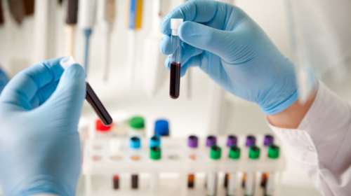 Με τεστ αίματος η διάγνωση και καταπολέμηση της κατάθλιψης