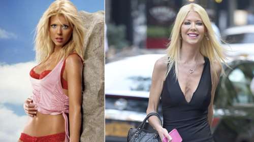 Η ανορεξία σαρώνει το Χόλιγουντ: Μεταμόρφωση - σοκ για πανέμορφη ηθοποιό