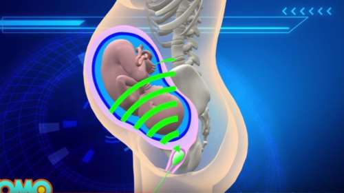 Babypod: Το γκάτζετ που μπαίνει στη μήτρα και παίζει μουσική στα έμβρυα!