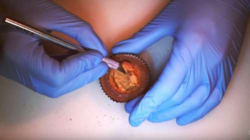 Το πιο παράξενο πράγμα που είδαμε σήμερα: Χειρούργος Φαγητών (VIDEO)