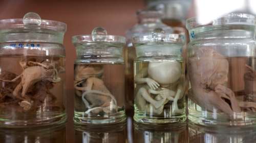 Πέταξε στα σκουπίδια 12 έμβρυα μέσα σε γυάλες