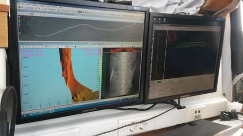 Ολοκληρώθηκε η πρώτη υποθαλάσσια έρευνα κοντά στη Δήλο. Τι έδειξε