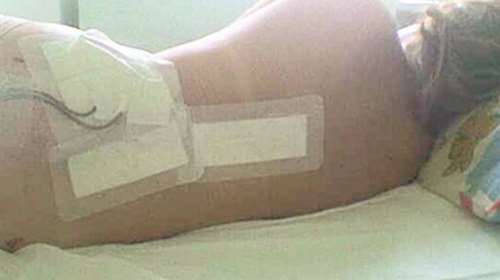 H συγκλονιστική εξομολόγηση μιας ελληνίδας για τη μάχη με τον καρκίνο