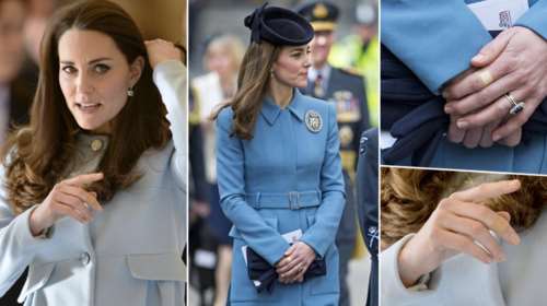 Γιατί η Κέιτ Μίντλετον φοράει σχεδόν πάντα λευκοπλάστ στα δάχτυλά της;