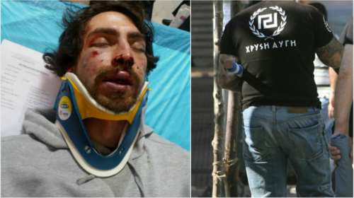 Μετακλητός υπάλληλος της Χ. Αυγής o συλληφθείς για την επίθεση