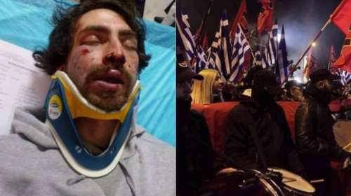 Πώς διέφυγαν οι χρυσαυγίτες μετά την επίθεση στον 24χρονο