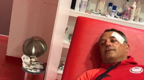 Ξύλο στα αποδυτήρια από τα ΜΑΤ- Τραυματίας ο φροντιστής του Ολυμπιακού