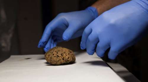 Ισπανία: Βρήκαν διατηρημένους εγκεφάλους σε μαζικό τάφο του εμφυλίου