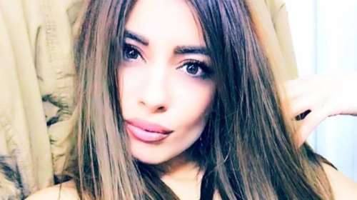 Αρναούτη: Δείχνει τις λάμες στα πόδια της μετά το τροχαίο με τον Παντελίδη