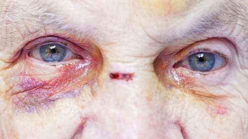 Κρήτη: Έβαλε κάμερες και είδε την κακοποίηση της 79χρονης μητέρας της