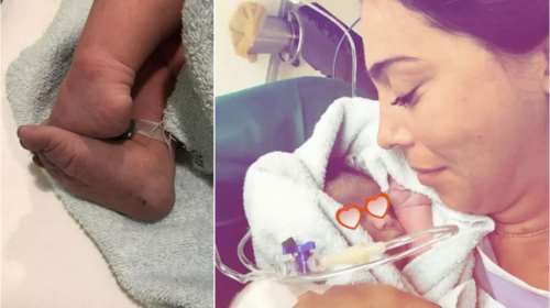 Η Χοψονίδου αγκαλιά με το νεογέννητο μωρό της αμέσως μετά τη γέννα [Βίντεο]