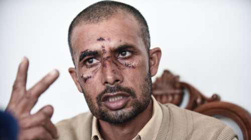 Ασπρόπυργος:Ταυτοποιήθηκε ανήλικος για την ρατσιστική επίθεση