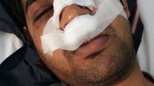 Νέα επίθεση δέκα ατόμων σε μετανάστη στα Άνω Πατήσια