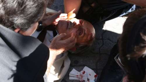 &#39;Ανδρας των ΜΑΤ γκρέμισε από σκάλα ηλικιωμένο - φωτό-