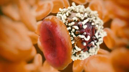 Μία έως δέκα μεταλλάξεις χρειάζονται για να ξεκινήσει ο καρκίνος