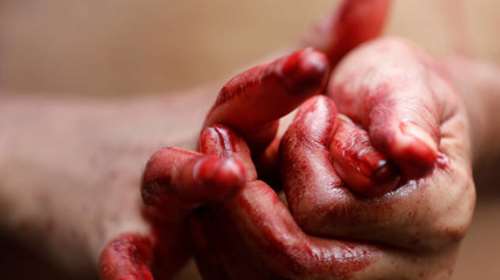 Μυστήριο με Ιταλίδα που αιμορραγεί από πρόσωπο και χέρια