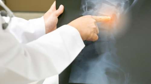 Μια ολόκληρη οικογένεια στην Ιταλία δεν νιώθει πόνο! Ο ρόλος ενός γονιδίου