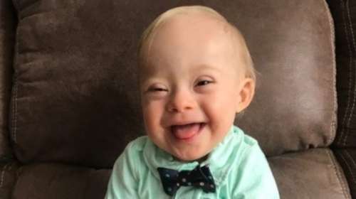 Το γελαστό μωρό με σύνδρομο Down, πρεσβευτής παιδικών τροφών