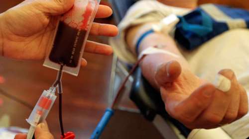 Πάνω από 10.000 οι ασθενείς σε αιμοκάθαρση το 2016