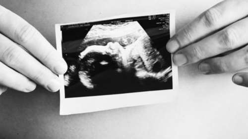 Δίκη στην Κω για άμβλωση σε 13χρονη - Στο εδώλιο δύο άνδρες