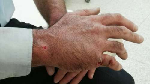 Έξι συλλήψεις για την επίθεση στους αστυνομικούς στην Πειραιώς