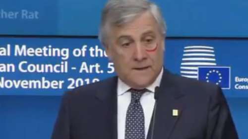 Με κραγιόν κάτω από το μάτι ο Ταγιάνι για την υποστήριξη των γυναικών