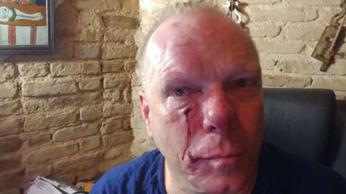 Συγκλονιστικό ντοκουμέντο - Η επίθεση φασιστών σε δημοσιογράφο