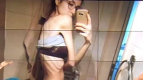 Πρώην παίκτρια GNTM: Έφτασα να ζυγίζω 37 κιλά, αλλά να με βλέπω χοντρή