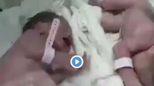 Συγκίνηση: Δίδυμα γεννήθηκαν 20&#39; μετά τον σεισμό στην Αλβανία