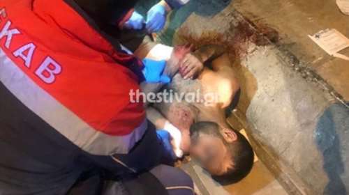 Θεσσαλονίκη: Του επιτέθηκαν με μαχαίρια και ξύλα για 50 ευρώ-Εικόνες